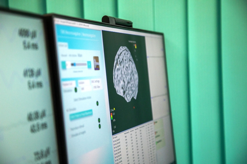 Ученых из Калининграда научились быстро диагностироват болезни головного мозга