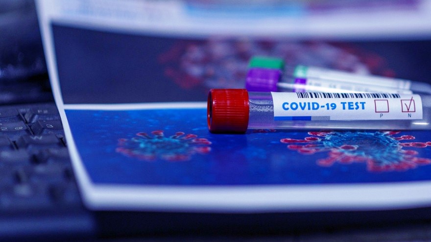 В Калининградской области число заразившихся COVID-19 превысило 25 тысяч